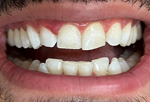 Finesse Dental Care Finesse Dental Care