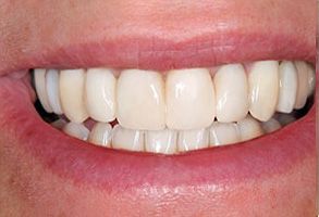 Finesse Dental Care Finesse Dental Care