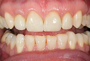 Finesse Dental Care Finesse Dental Care