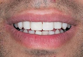 Finesse Dental Care Finesse Dental Care
