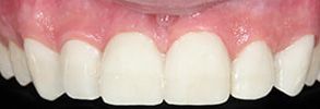 Finesse Dental Care Finesse Dental Care