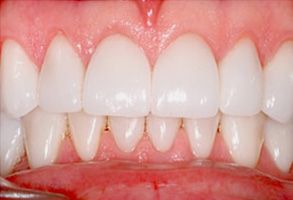 Finesse Dental Care Finesse Dental Care