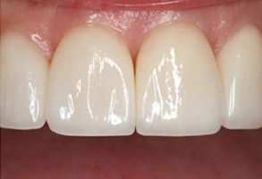 Finesse Dental Care Finesse Dental Care