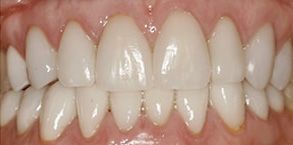 Finesse Dental Care Finesse Dental Care