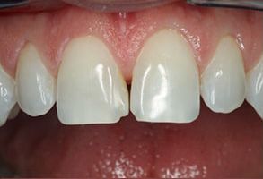 Finesse Dental Care Finesse Dental Care