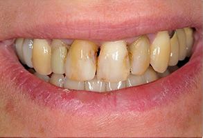 Finesse Dental Care Finesse Dental Care