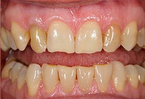 Finesse Dental Care Finesse Dental Care