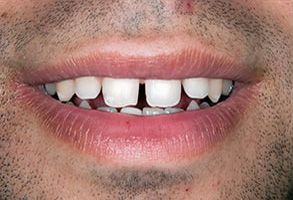 Finesse Dental Care Finesse Dental Care