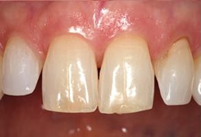 Finesse Dental Care Finesse Dental Care