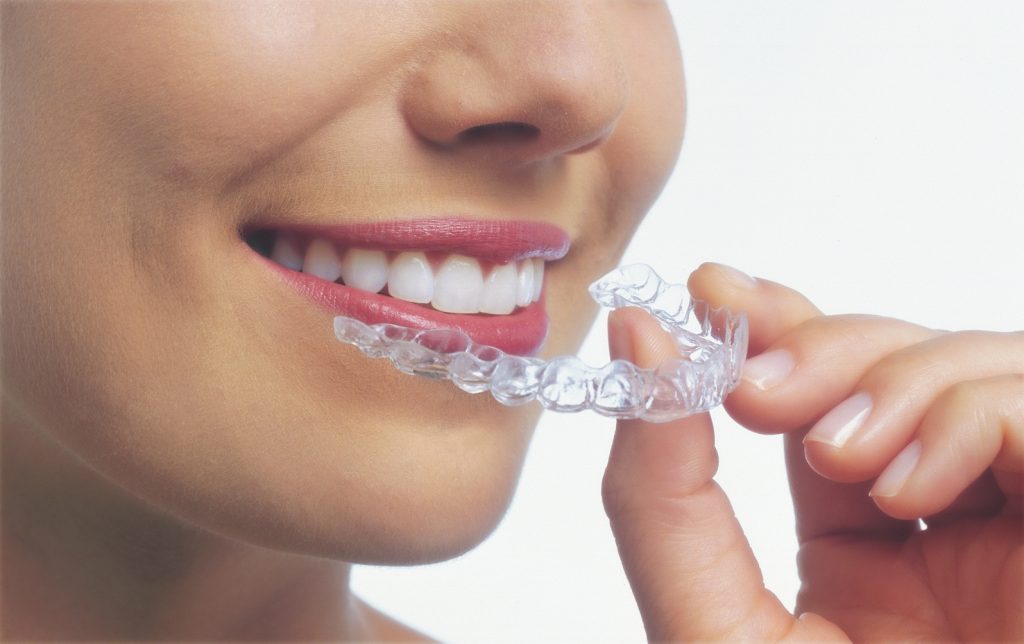 Invisalign Invisalign