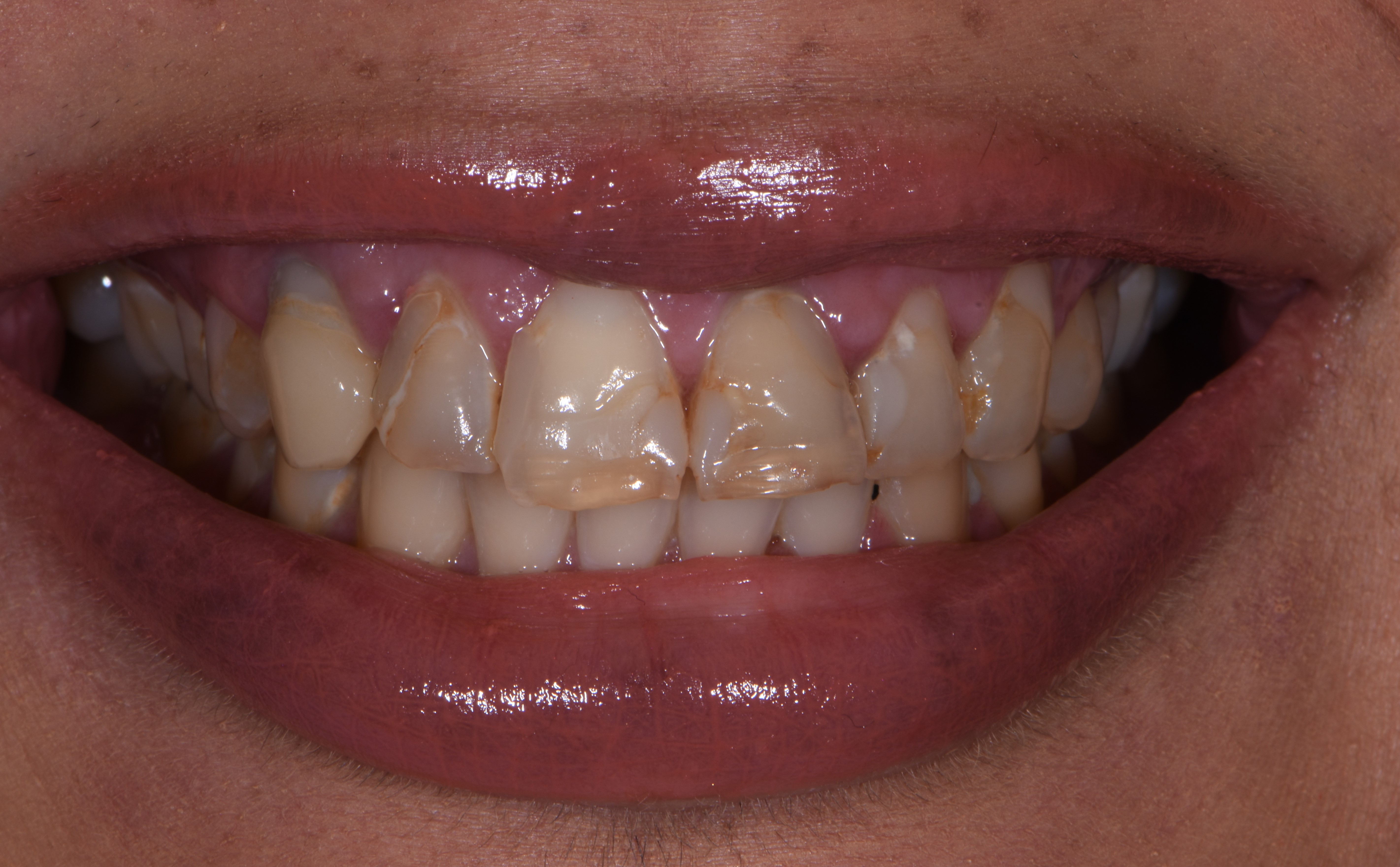 Finesse Dental Care Finesse Dental Care