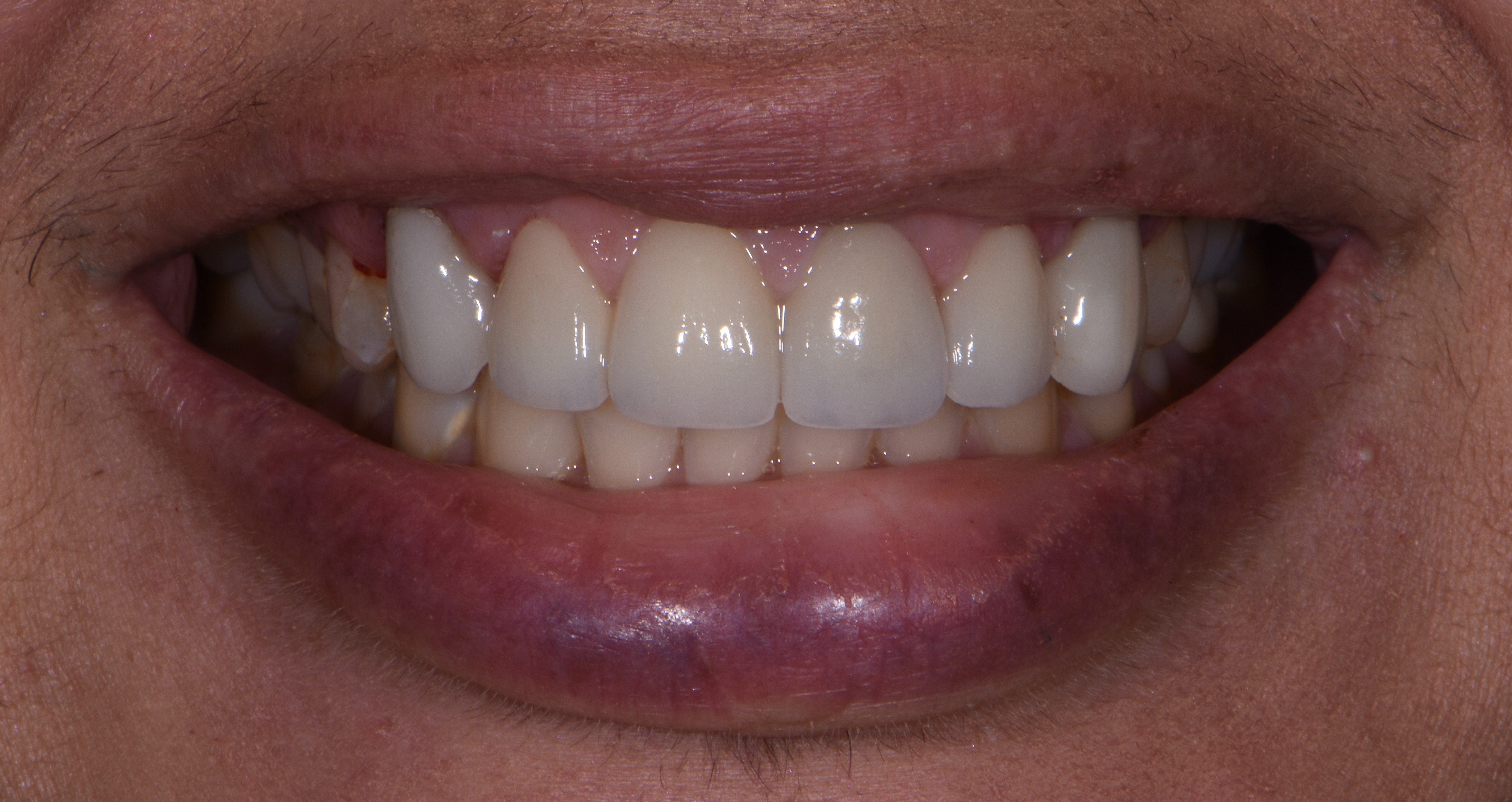 Finesse Dental Care Finesse Dental Care