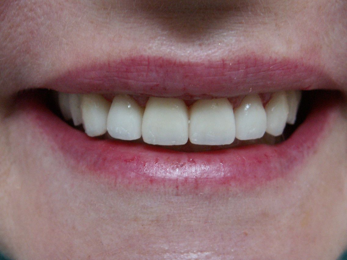 Finesse Dental Care Finesse Dental Care