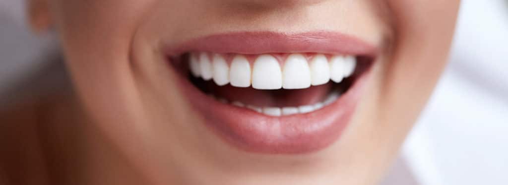 One Visit Dental Crowns One Visit Dental Crowns