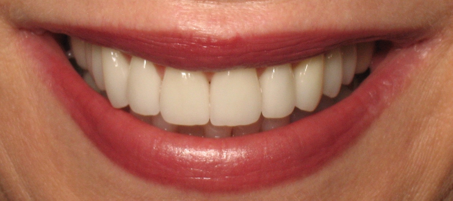 Finesse Dental Care Finesse Dental Care
