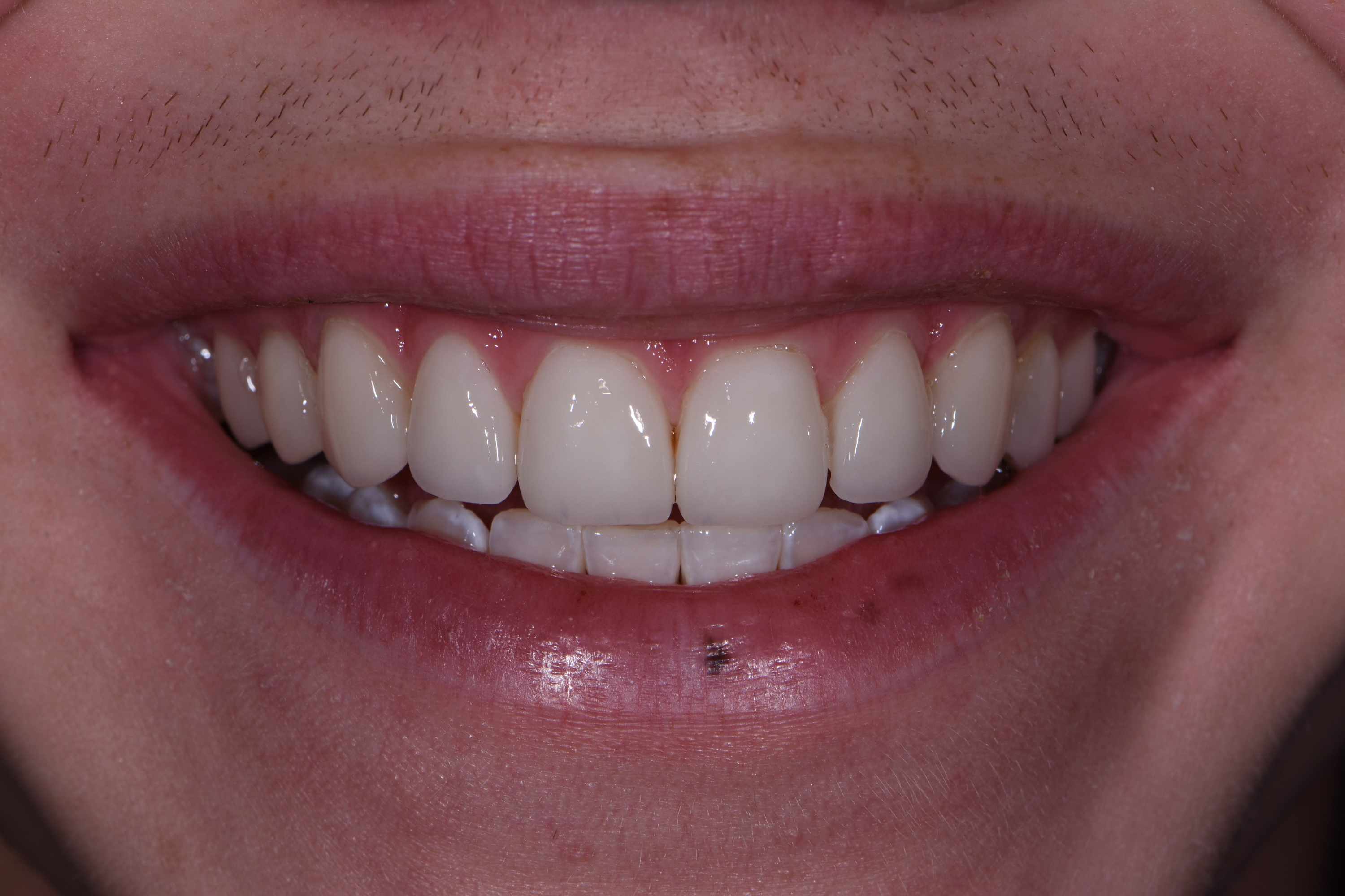 Finesse Dental Care Finesse Dental Care