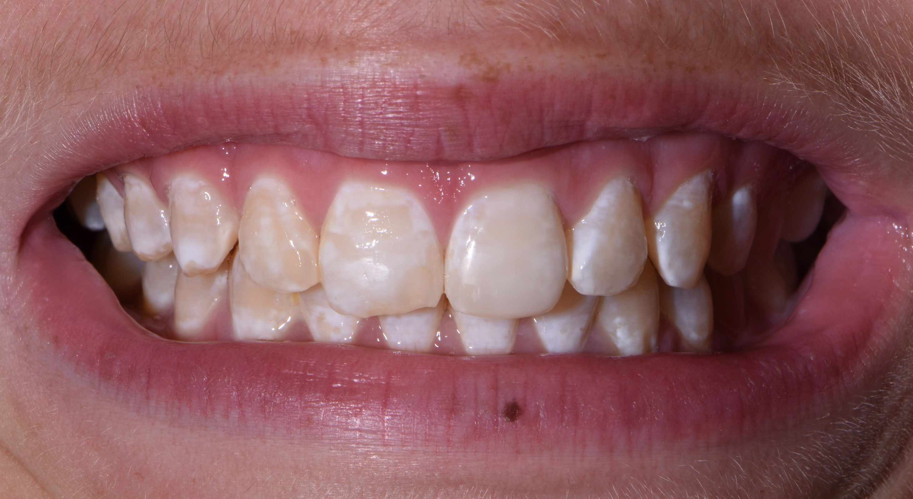 Finesse Dental Care Finesse Dental Care
